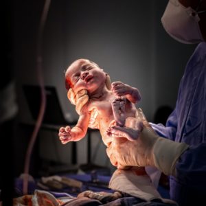 Using hypnosis childbirth modality